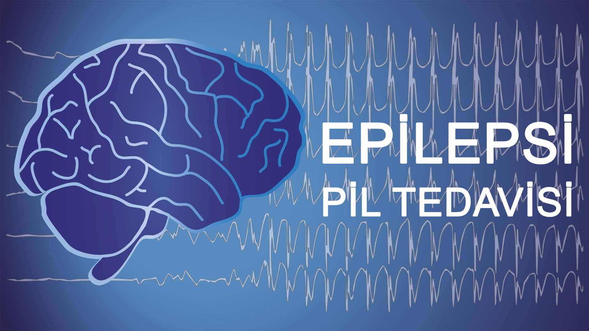 Epilepsi Pili - Vagus Sinir Stimülasyonu